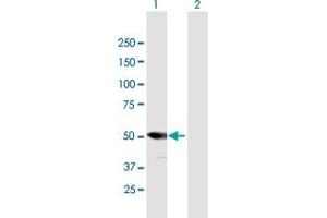 Western Blotting (WB) image for anti-Proteasome (Prosome, Macropain) 26S Subunit, Non-ATPase, 5 (PSMD5) (AA 1-504) antibody (ABIN948340)