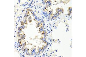 Immunohistochemistry of paraffin-embedded rat lung using SHH antibody (ABIN5975790) at dilution of 1/100 (40x lens). (Sonic Hedgehog 抗体)