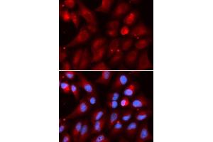 Immunofluorescence (IF) image for anti-Proteasome (Prosome, Macropain) Subunit, beta Type 2 (PSMB2) (AA 1-201) antibody (ABIN6146314)