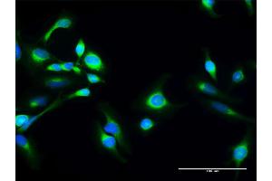Immunofluorescence of purified MaxPab antibody to SACM1L on HeLa cell. (SACM1L 抗体  (AA 1-587))