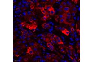 Immunofluorescence of paraffin embedded human liver using RBP (ABIN7075409) at dilution of 1: 650 (400x lens) (RBP4 抗体)