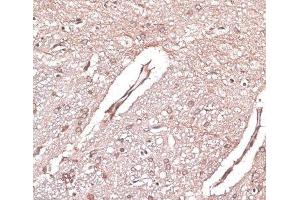 Immunohistochemistry of paraffin-embedded Rat brain using LMO4 Polyclonal Antibody at dilution of 1:100 (40x lens). (LMO4 抗体)