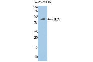 Western Blotting (WB) image for anti-Complement Factor B (CFB) (AA 35-160) antibody (ABIN3205634) (Complement Factor B 抗体  (AA 35-160))
