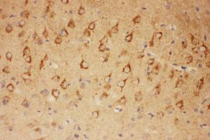 Anti-CNTF Picoband antibody,  IHC(P): Rat Brain Tissue (CNTF 抗体  (AA 2-200))
