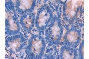 Immunohistochemistry (IHC) image for anti-Nitric Oxide Synthase Trafficker (NOSTRIN) (AA 1-245) antibody (ABIN7432256)