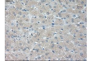 Immunohistochemical staining of paraffin-embedded liver tissue using anti-HSD17B10 mouse monoclonal antibody. (HSD17B10 抗体)
