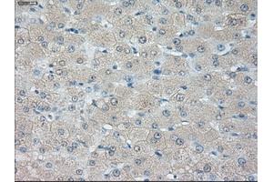 Immunohistochemical staining of paraffin-embedded liver tissue using anti-HSD17B10 mouse monoclonal antibody. (HSD17B10 抗体)