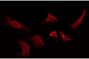ABIN6267260 staining SK-OV3 by IF/ICC. (EGFR 抗体  (pTyr1016))