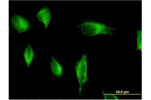 Immunofluorescence of monoclonal antibody to PIK3C2A on HeLa cell. (PIK3C2A 抗体  (AA 1577-1686))