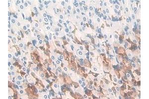 Detection of GIF in Rat Stomach Tissue using Polyclonal Antibody to Gastric Intrinsic Factor (GIF) (Intrinsic Factor 抗体  (AA 196-414))