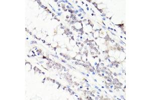 Immunohistochemistry of paraffin-embedded human colon using FKBP5 antibody. (FKBP5 抗体  (AA 308-457))