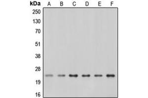 Western blot analysis of Caveolin 1 expression in A549 (A), A431 (B), NIH3T3 (C), mouse kidney (D), rat kidney (E), rat heart (F) whole cell lysates. (Caveolin-1 抗体  (C-Term))