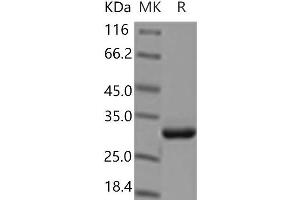 Western Blotting (WB) image for Amyloid P Component, Serum (APCS) protein (His tag) (ABIN7321229)