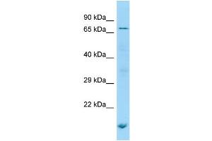 WB Suggested Anti-POF1B Antibody Titration: 1. (POF1B 抗体  (N-Term))