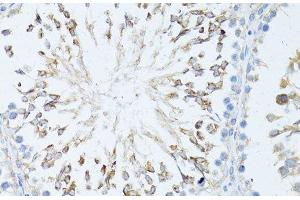 Immunohistochemistry of paraffin-embedded Rat testis using TEFM Polyclonal Antibody at dilution of 1:100 (40x lens).