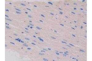 Used in DAB staining on fromalin fixed paraffin- embedded testis tissue (IL13 Receptor alpha 1 抗体  (AA 201-360))