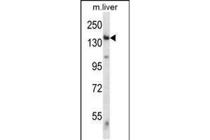 Western blot analysis in mouse liver tissue lysates (35ug/lane). (GCN2 抗体  (C-Term))