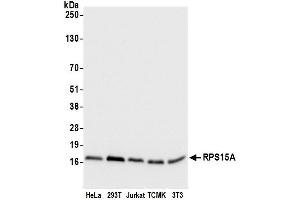 anti-Ribosomal Protein S15a (RA) (AA 1-50) antibody