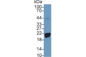 Western Blotting (WB) image for anti-Ferritin, Heavy Polypeptide 1 (FTH1) antibody (ABIN7437164)
