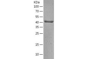 Acetyl-CoA Acetyltransferase 2 (ACAT2) (AA 1-397) protein (His-IF2DI Tag)