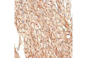 Immunohistochemistry of paraffin-embedded rat heart using Caveolin-3 Rabbit mAb (ABIN7266157) at dilution of 1:100 (40x lens). (Caveolin 3 抗体)