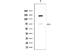 Western blot analysis of lysates from Rat brain, using ADAM23 Antibody at 1/1000 dilution.