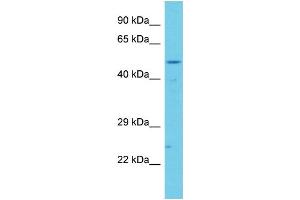 Host: Rabbit Target Name: CCDC41 Sample Type: Jurkat Whole Cell lysates Antibody Dilution: 1. (CCDC41 抗体  (C-Term))
