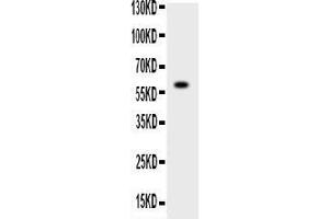 Western blot analysis of ADAMTS4 using anti-ADAMTS4 antibody . (ADAMTS4 抗体  (C-Term))