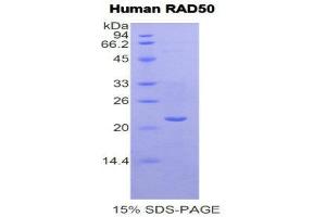 SDS-PAGE (SDS) image for RAD50 Homolog (S. Cerevisiae) (RAD50) (AA 631-793) protein (His tag) (ABIN1877518)