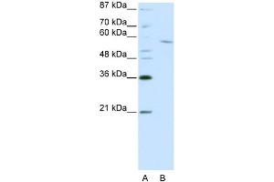 WB Suggested Anti-RCOR1 Antibody Titration:  0. (CoREST 抗体  (C-Term))