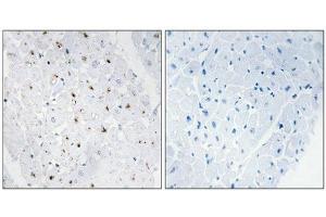 Immunohistochemical analysis of paraffin-embedded human heart tissue, using Bloom Syndrome Protein (Phospho-Thr99) antibody (left)or the same antibody preincubated with blocking peptide (right). (BLM 抗体  (pThr99))