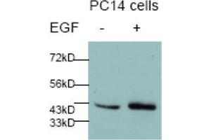 Image no. 2 for anti-Jun Proto-Oncogene (JUN) (pSer73) antibody (ABIN196612) (C-JUN 抗体  (pSer73))