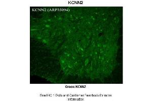 Immunohistochemistry (IHC) image for anti-Potassium Intermediate/small Conductance Calcium-Activated Channel, Subfamily N, Member 2 (KCNN2) (C-Term) antibody (ABIN2776144)