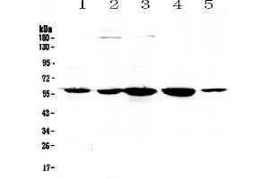Western blot analysis of ETV6/Tel using anti-ETV6/Tel antibody . (ETV6 抗体  (AA 327-448))