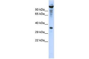 Western Blotting (WB) image for anti-Ribonuclease T2 (RNASET2) antibody (ABIN2458003) (RNASET2 抗体)