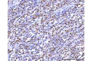 IHC analysis of RNGTT using anti-RNGTT antibody (ABIN7599723).