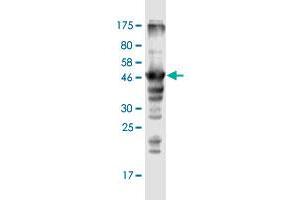 Western Blot detection against Immunogen (47. (MRPL12 抗体  (AA 1-198))