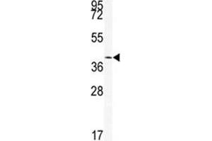 Western blot analysis of SIRT6 antibody and mouse stomach tissue lysate (SIRT6 抗体  (AA 290-319))
