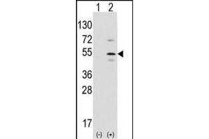 Western Blotting (WB) image for anti-Pancreas Specific Transcription Factor, 1a (PTF1A) (AA 12-43), (N-Term) antibody (ABIN1881703)
