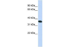 C21ORF59 antibody used at 1 ug/ml to detect target protein. (C21orf59 抗体  (N-Term))