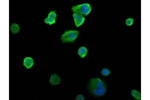 Immunofluorescence staining of MCF-7 cells with ABIN7151218 at 1:200, counter-stained with DAPI. (SIAH2 抗体  (AA 1-72))