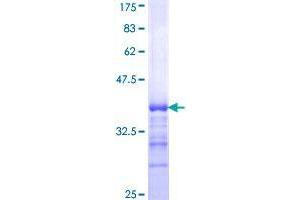 SHANK2 Protein (AA 1034-1124) (GST tag)