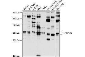 Western blot analysis of extracts of various cell lines, using CNOT7 antibody (ABIN6127563, ABIN6138783, ABIN6138784 and ABIN6224834) at 1:1000 dilution. (CNOT7 抗体  (AA 90-160))