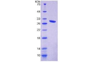 SDS-PAGE analysis of Mouse CHRNe Protein. (CHRNE 蛋白)