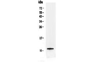 Western blot analysis of TFF3 using anti-TFF3 antibody . (TFF3 抗体  (AA 23-81))
