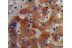 Used in DAB staining on fromalin fixed paraffin-embedded Liver tissue (IL1RN 抗体  (AA 27-178))
