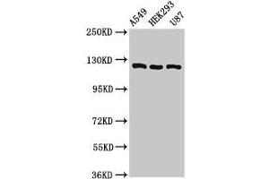 Western Blot Positive WB detected in: A549 whole cell lysate, HEK293 whole cell lysate, U87 whole cell lysate All lanes: ACLY antibody at 8 μg/mL Secondary Goat polyclonal to rabbit IgG at 1/50000 dilution Predicted band size: 121, 120, 92 kDa Observed band size: 121 kDa (ACLY 抗体  (AA 4-265))