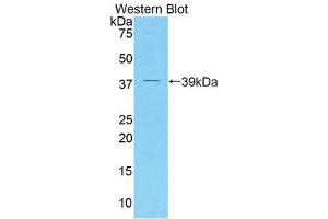 Western Blotting (WB) image for anti-Dickkopf Homolog 4 (Xenopus Laevis) (DKK4) (AA 37-141) antibody (ABIN3202023) (DKK4 抗体  (AA 37-141))