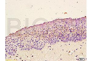 Immunohistochemistry (IHC) image for anti-Neurotrophic Tyrosine Kinase, Receptor, Type 2 (NTRK2) (AA 401-500) antibody (ABIN725870)