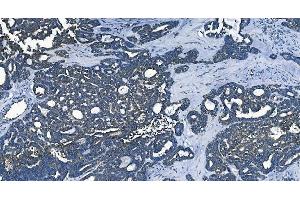 IHC analysis of PCBP2/hnRNP E2 using anti-PCBP2/hnRNP E2 antibody (ABIN7600449). (PCBP2 抗体  (AA 197-276))